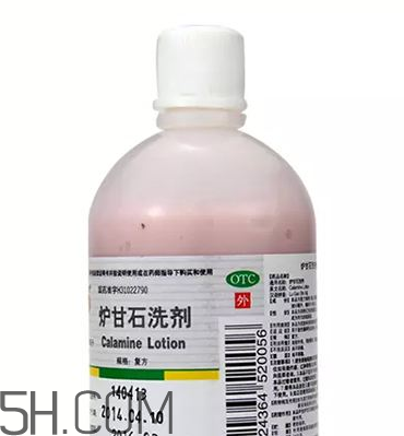 爐甘石洗劑是洗還是擦？爐甘石洗劑是什么顏色？