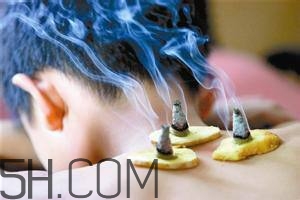 艾灸對(duì)慢性咽炎有用嗎？慢性咽炎可以通過(guò)艾灸來(lái)治療嗎？
