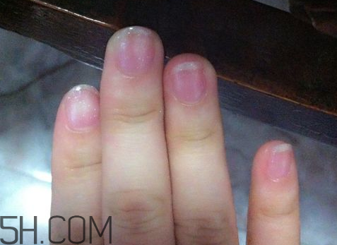 美甲后指甲受損怎么辦？指甲破損怎么修復(fù)？