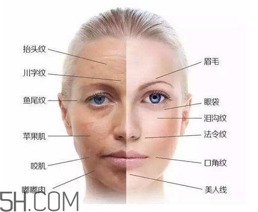怎么預(yù)防皺紋的產(chǎn)生？導(dǎo)致皺紋的產(chǎn)生的原因有哪些？