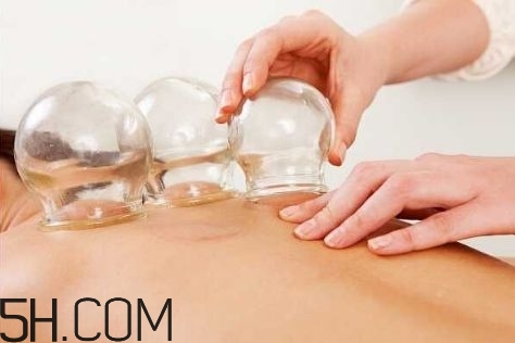 拔罐可以治療鼻炎嗎？鼻炎拔罐拔哪里？