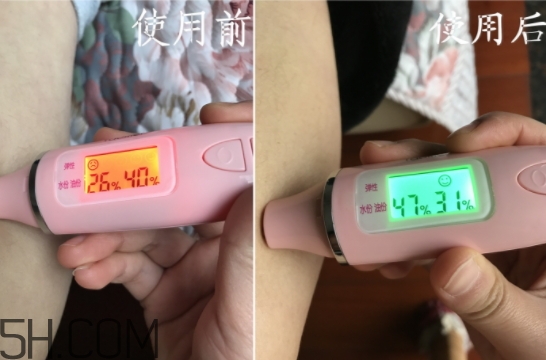 水楊酸可以去黑頭嗎？水楊酸可以去閉口嗎