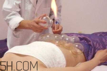 腹部拔罐可以減肥嗎？腹部拔罐拔哪個(gè)位置？
