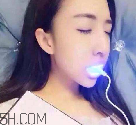美牙儀可以兩個(gè)人用嗎？美牙儀用多久才有作用？