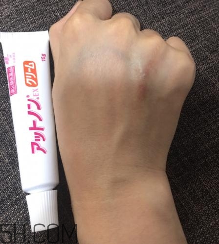 小林制藥祛疤膏有效嗎？小林制藥祛疤膏怎么樣？