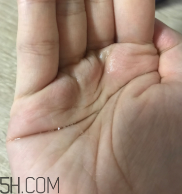 雪肌精卸妝油糊眼睛嗎？雪肌精卸妝油悶痘嗎？