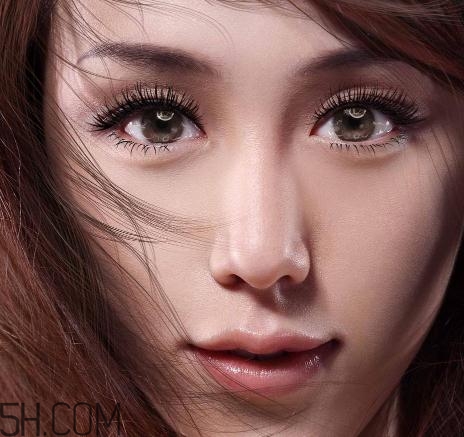 上瞼提肌手術(shù)有必要嗎？上瞼提肌后是永久的嗎？