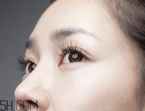 上瞼提肌手術(shù)有必要嗎？上瞼提肌后是永久的嗎？