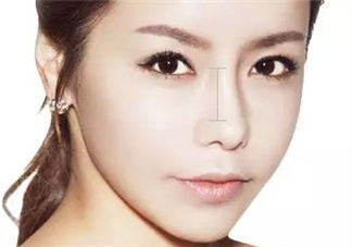 達(dá)拉斯隆鼻是什么材料？達(dá)拉斯隆鼻怎么樣？