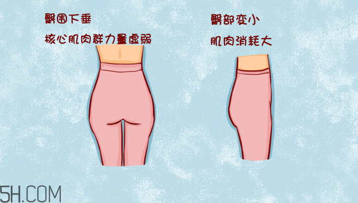 臀部護(hù)理對(duì)健康有什么影響？日常如何保養(yǎng)臀部健康？