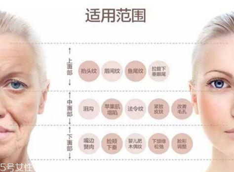 大v線會(huì)斷嗎？一定要選擇正規(guī)整形醫(yī)院