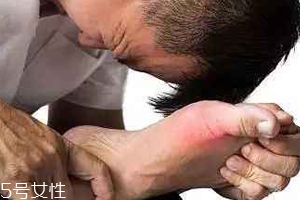 痛風(fēng)可以治愈嗎？無法治愈但能控制