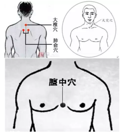 吮痧有什么療效？最溫柔的治病方法