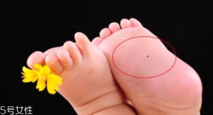 痣什么情況下會(huì)轉(zhuǎn)變?yōu)榱?？點(diǎn)痣不可取