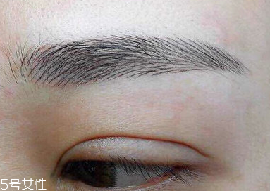 激光洗眉恢復(fù)期有疤痕怎么辦？激光洗眉毛之后正確護(hù)理方法
