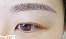 激光洗眉恢復(fù)期有疤痕怎么辦？激光洗眉毛之后正確護(hù)理方法