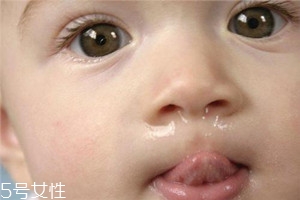 冬季寶寶流鼻涕是什么原因？教你幾招輕松應(yīng)對(duì)