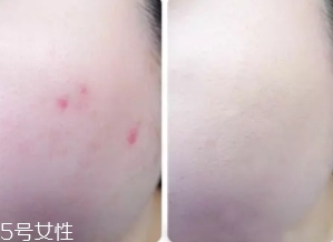 cpb遮瑕棒怎么樣？來看看使用效果
