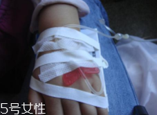 輸液治療不適合哪些病？過(guò)敏反應(yīng)危害大