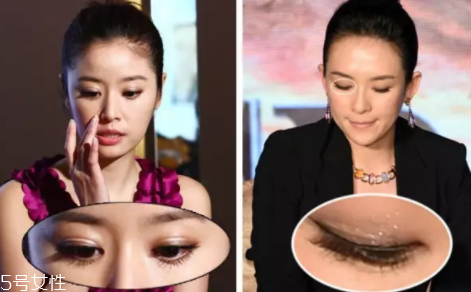 內(nèi)雙怎么進(jìn)化成雙眼皮？全是雙眼皮貼的功勞