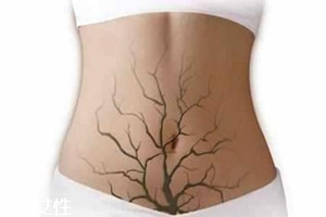 體內(nèi)毒素超標(biāo)有何表現(xiàn)？五大癥狀須注意