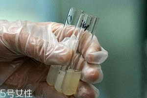 捐精有什么危害？專家稱沒有危害