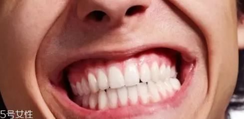 磨牙是因?yàn)槭芰宋?？孩子的心理狀況也會(huì)導(dǎo)致磨牙