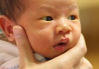 新生兒長黃疸怎么辦？有些黃疸癥狀媽媽們可別忽視