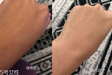 美白精華只能晚上用嗎？白天要做好防曬