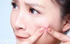 肌膚需要排毒嗎？長(zhǎng)痘并不代表排毒