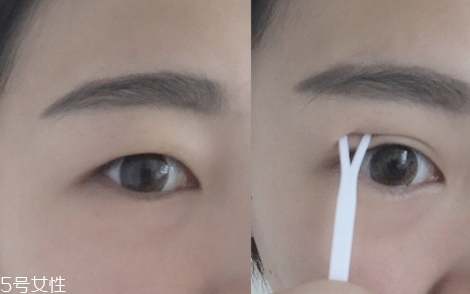 雙眼皮貼一般多少錢(qián)？