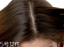 油性頭發(fā)跟什么有關(guān)？離不了這6個(gè)原因