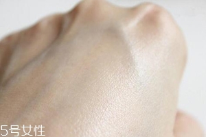 白癜風(fēng)與身體免疫功能有關(guān)系嗎？?jī)烧哧P(guān)系密切