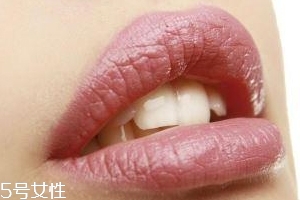 冬天爛嘴角什么原因？有可能營養(yǎng)不良