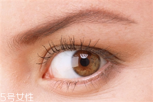 開眼角會影響視力嗎？開眼角會有危害