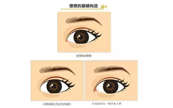 開外眼角和開內(nèi)眼角哪個(gè)好？開眼角有可能會(huì)回縮