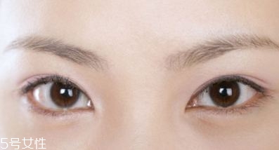 割雙眼皮的術(shù)前準(zhǔn)備有哪些？割雙眼皮的常見做法