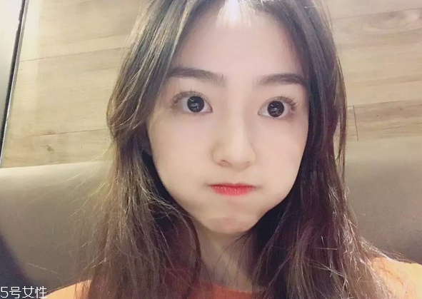 割雙眼皮要注意什么？割雙眼皮充血是正?，F(xiàn)象