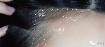 眉粉可以當(dāng)發(fā)際線粉嗎？解救高發(fā)際線的技巧
