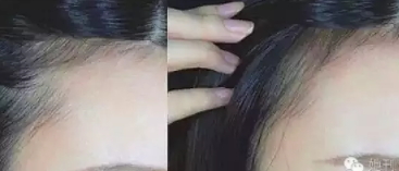 眉粉可以當(dāng)發(fā)際線粉嗎？解救高發(fā)際線的技巧