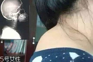 富貴包是什么??？姿態(tài)優(yōu)美少犯病
