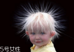 少年白什么原因？焦慮緊張會(huì)得病