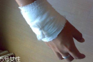 被蜈蚣咬傷后能治愈嗎？科學(xué)家有新發(fā)現(xiàn)