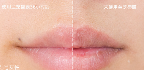 蘭芝唇膜吃進去怎么辦？擁有水嫩嘴唇