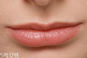嘴唇干裂是一種病嗎？治療口角炎從改善習(xí)慣入手