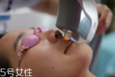 科技脫毛有哪些種類？冰點脫毛不毀毛囊