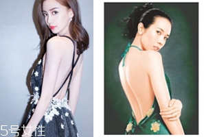 怎樣矯正背溝缺失？減肥運(yùn)動(dòng)是關(guān)鍵