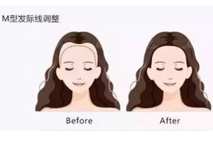 發(fā)際線粉填充和發(fā)際線筆哪個好？配合使用才最完美