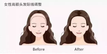發(fā)際線粉填充和發(fā)際線筆哪個(gè)好？配合使用才最完美