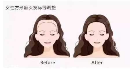 發(fā)際線粉填充和發(fā)際線筆哪個(gè)好？配合使用才最完美